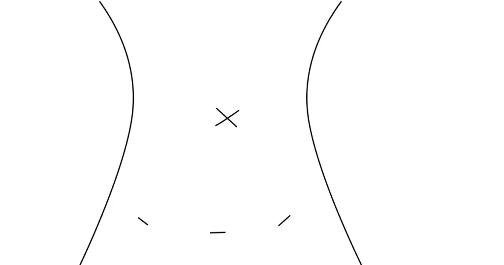 腹腔鏡手術の傷